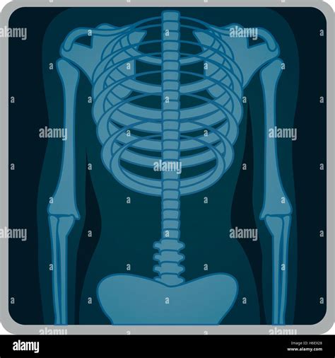 Radiografía De Tórax Imagen De Icono Diseño Ilustración Vectorial