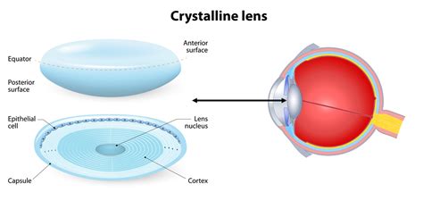 Lens Eye Patient