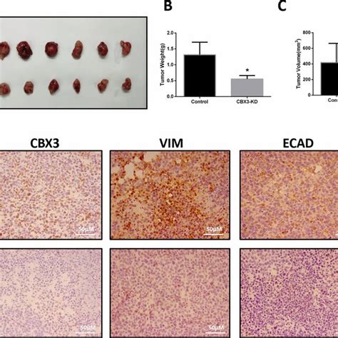 Knockdown Of Cbx In Ccrcc Cells Inhibited Cell Growth And Induced Cell