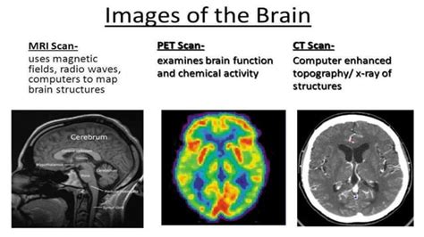 Nuclear medicine PET scan