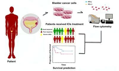 urine based test offers hope  bladder cancer patients