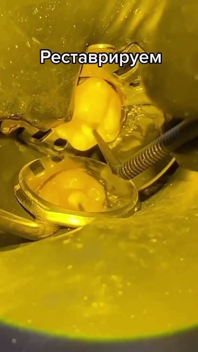 Вторичный кариес 😧🦷 Почему он возникает и как предотвратить его ...