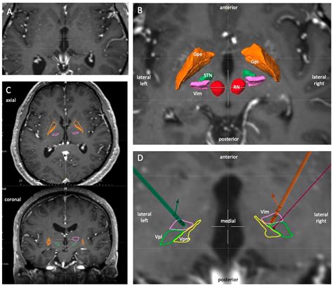 Brain Sciences Free Full Text Evaluation Of Automatic Segmentation