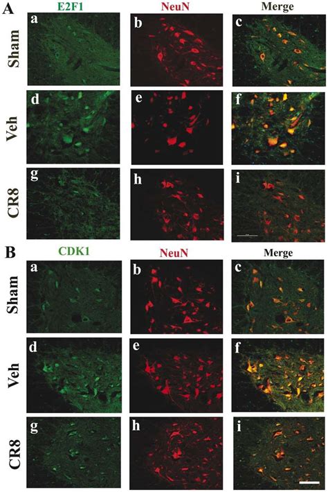 SCI-induced immunoreactivity of E2F1 and CDK1 was attenuated by CR8 ... 