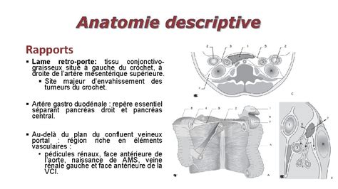 Radio Anatomie Normale Du Pancras Ses Variantes Et