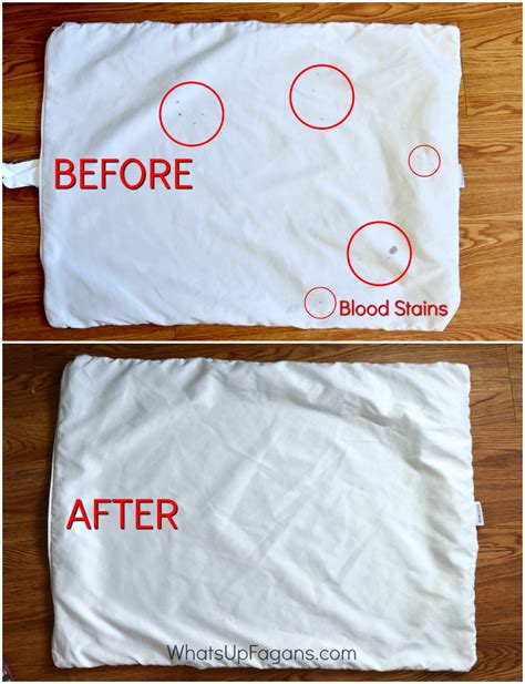 How To Remove Dried Set In Blood Stains From Clothes