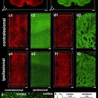 3D Visualization Of NeuN Positive Cell Loss 24 H After MCAO A B 3D