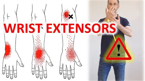 Tennis Elbow Lateral Epicondylitis The Best Stretches For The Wrist