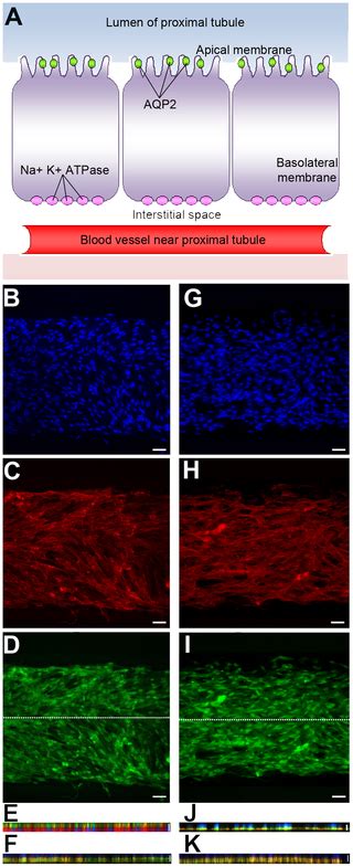 A Bioartificial Renal Tubule Device Embedding Human Renal Stemprogenitor Cells