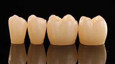 Prettau Anterior Zirconia Zirkonzahn Worldwide