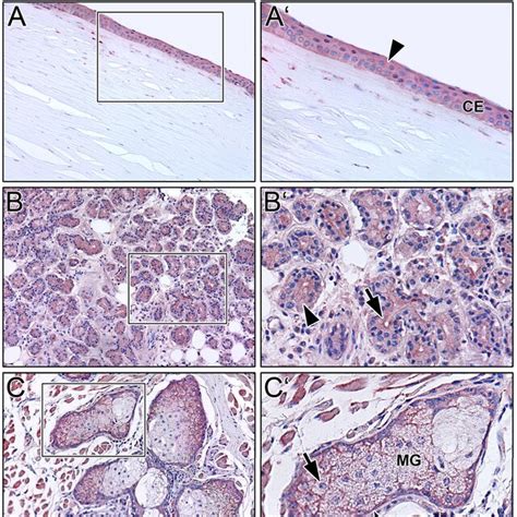 Immunohistochemical Analyses Of Prolactin Receptor Prlr In The Human