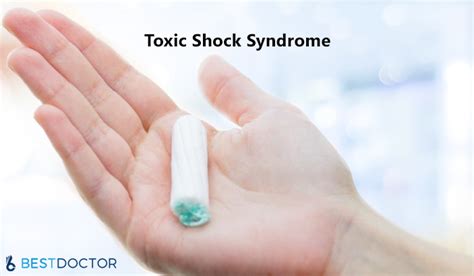 Toxic Shock Syndrome Rash And Other Symptoms With Pictures