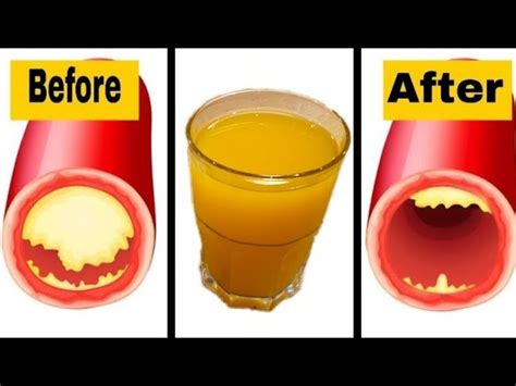 This Drink Will Unclog Arteries And Protects Against Heart Diseases