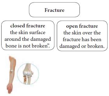 Fracture - Causes, Types | First Aid