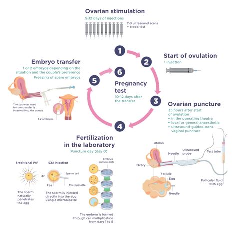 In Vitro Fertilisation