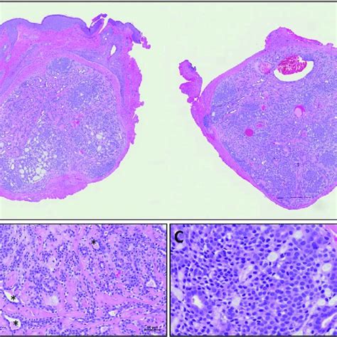 Hande Stains A Low Power 1× Image Of The Lesion It Is Download