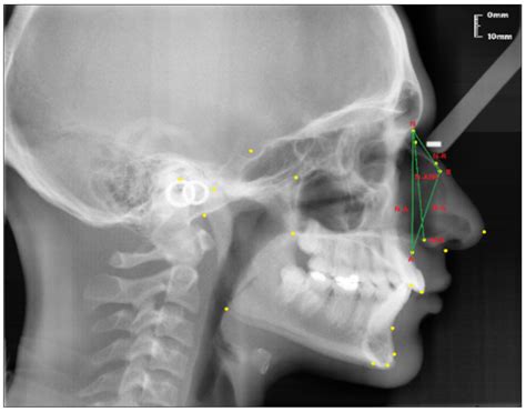 Diagnostics Free Full Text Investigation Of The Relationship