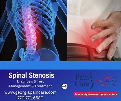 Spinal Stenosis Diagnosis Test Management Treatment Pain Care