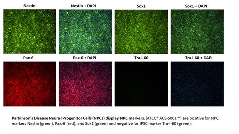 Proliferative Ipsc Derived Neural Precursor Cells Npcs Off