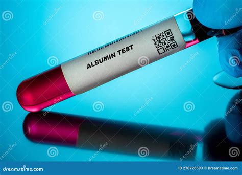Albumina Exame De Sangue - Análises Sanguíneas à Albumina Para Adultos Mais Velhos. Exame De ...
