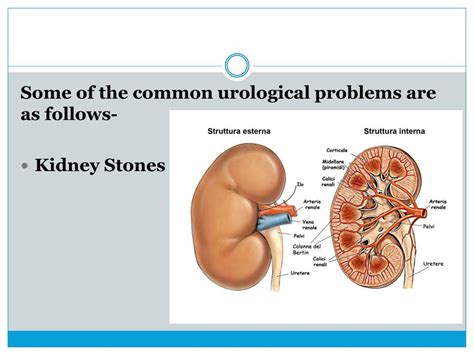 Ppt Common Types Of Urological Diseases Powerpoint Presentation Free