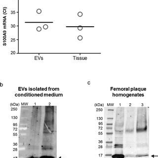 S A Expression On Human Femoral Evs And Arterial Tissue A