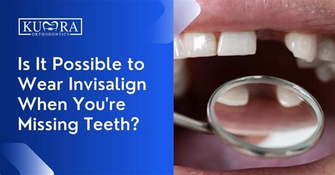 Is It Possible To Wear Invisalign When You Re Missing Teeth Kumra Orthodontics