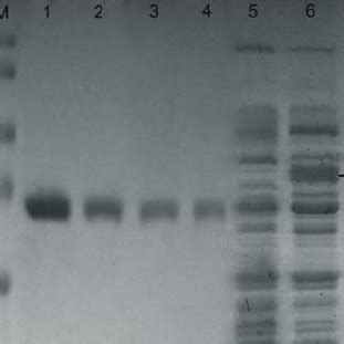 Electropherogram Showing The Presence Of The E Coli Recombinant Clone