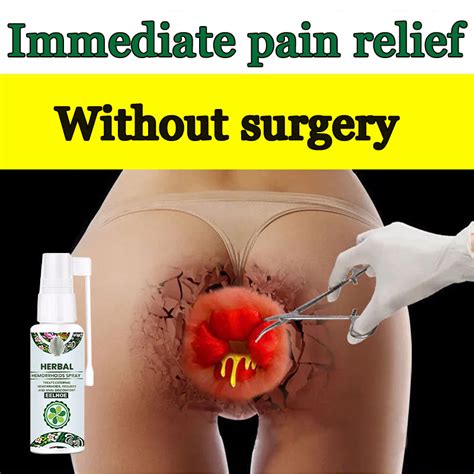 Without Surgery No Recurrenceherbal Ml Gamot Sa Almuranas Hemmoroid