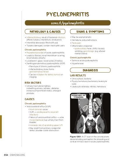 Chronic pyelonephritis: Video, Causes, & Meaning | Osmosis