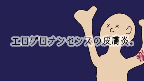 エログロナンセンスの皮膚病 Pornhub Gay