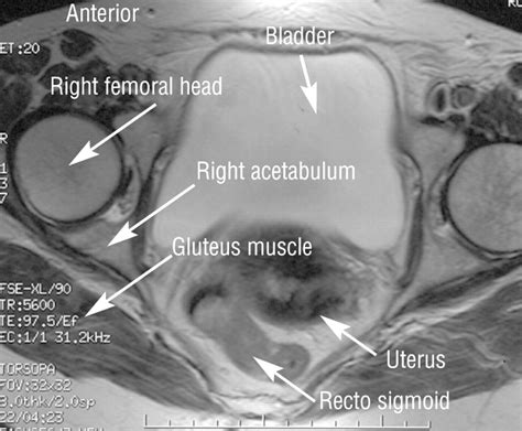 Magnetic Resonance Imaging The Bmj