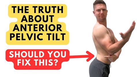 The Truth About Fixing Anterior Pelvic Tilt Is It Worth It Youtube