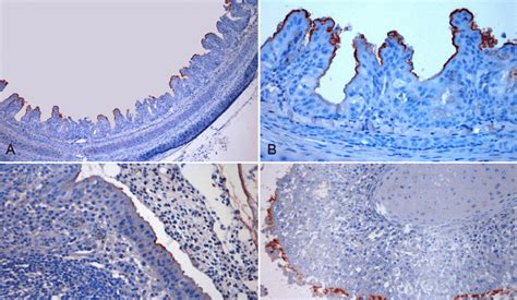 Imuno Histoqu Mica Anti Mycoplasma Gallisepticum A Traqueia