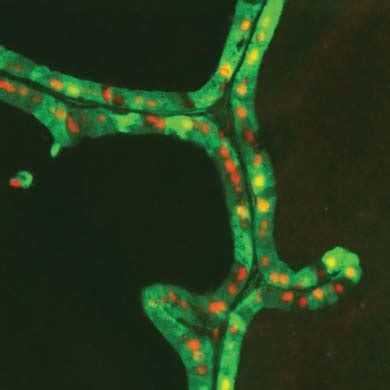 Direct Differentiation Of Spermatogonial Stem Cells Into Prostatic