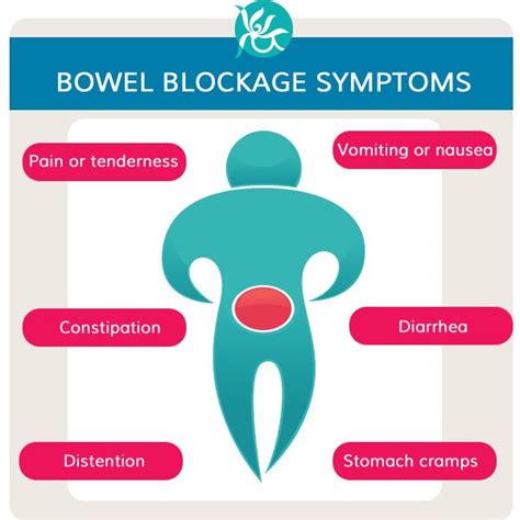 17 Best images about Small Bowel Obstruction on Pinterest | Physical ...