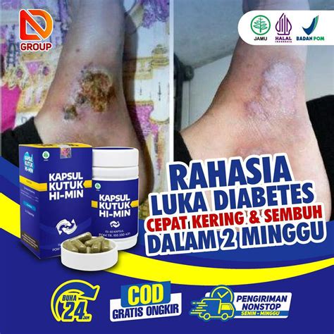 Jual Kapsul Kutuk Premium Original Ekstrak Albumin Ikan Gabus Obat