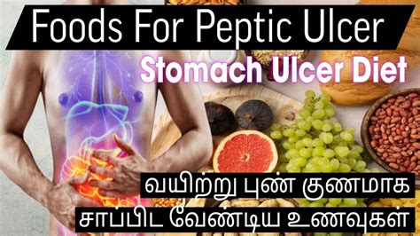 Stomach Ulcer Diet Best Foods For Stomach Ulcers Foods For Peptic Ulcer Health News Tamil