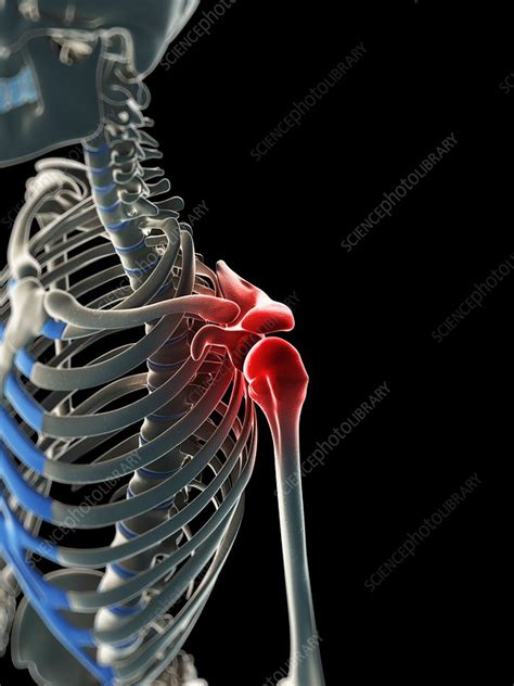 Shoulder Pain Conceptual Artwork Stock Image F006 3211 Science