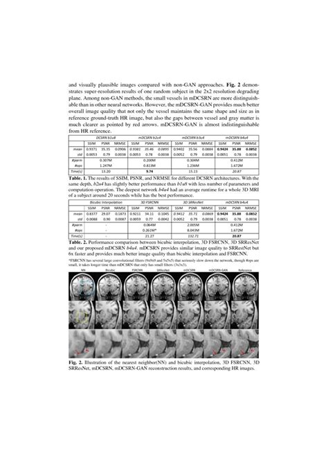 Efficient And Accurate Mri Super Resolution Using A Generative Adversarial Network And 3d Multi