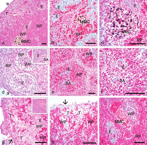 Spleen Diagram Histology