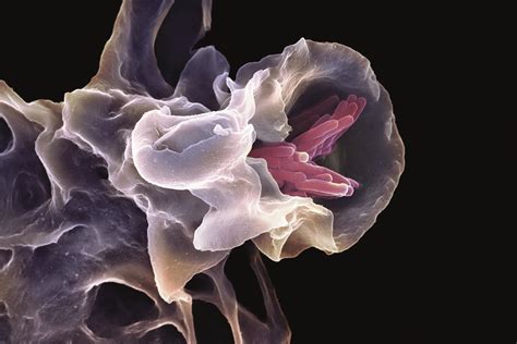 TB in London: in search of a 21st century approach - The Pharmaceutical ...