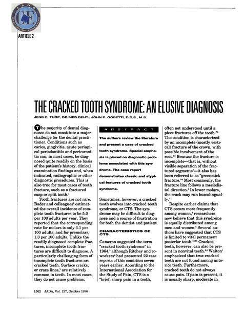 TÜRP The cracked tooth syndrome An elusive diagnosis ARTICLE