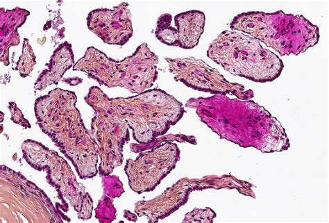 Mesothelium Histology