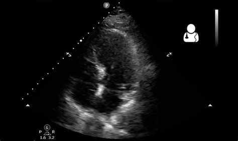 UOTW #36 - Core Ultrasound