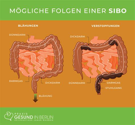 Sibo D Nndarmfehlbesiedlung Naturheilpraxis Gesund In Berlin