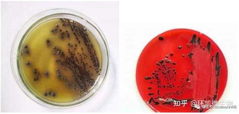 【速看】常见微生物在常见选择性培养基上的菌落特征 知乎