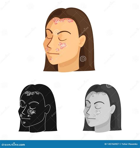 Vector Design Of Psoriasis And Skin Icon Set Of Psoriasis And Allergy