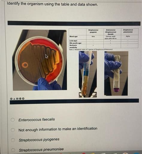 Solved QUESTION 1 can be hydrolyzed into The bile esculin | Chegg.com