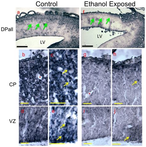 Photomicrographs Showing The Immuno Histochemical Localization Of